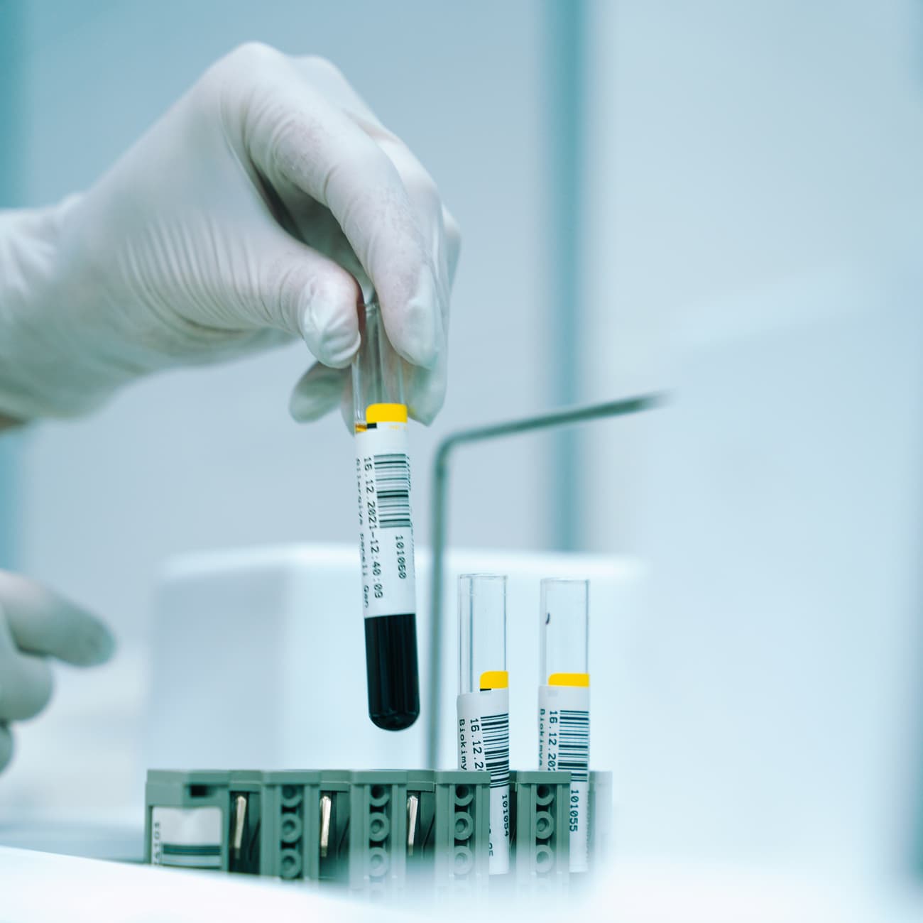 Gloved hand placing a sample tube in a rack